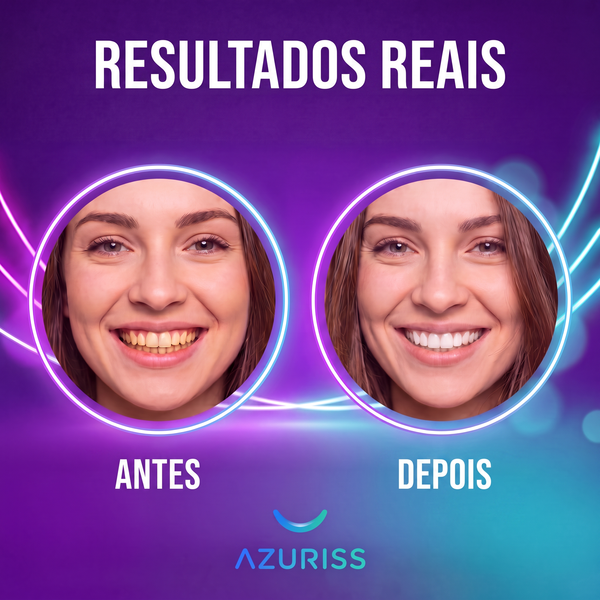 Resultados reais — antes e depois