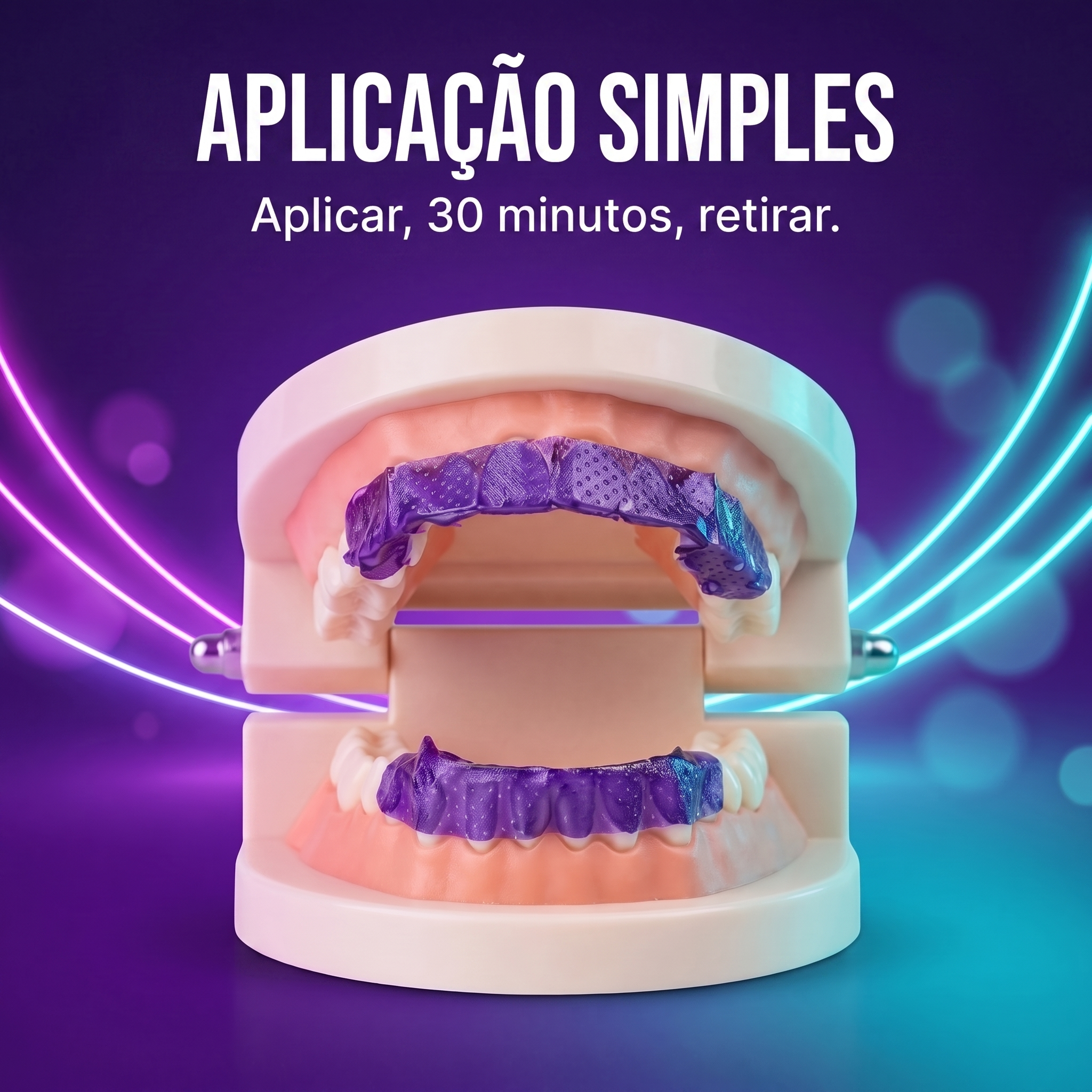 Aplicação simples nas arcadas superior e inferior